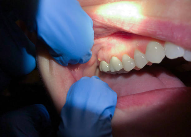 Best Walk-In Emergency Dentist in Browns Mills, NJ